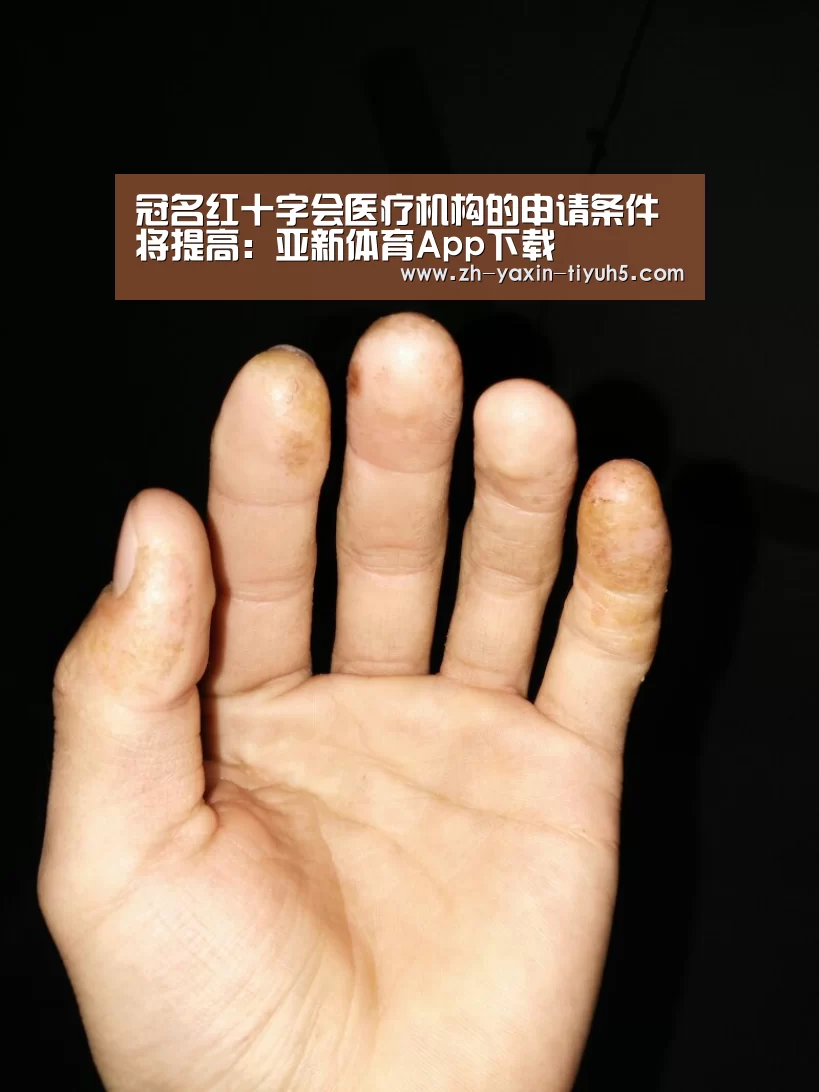 冠名红十字会医疗机构的申请条件将提高:亚新体育App下载(图2) 亚新体育App下载